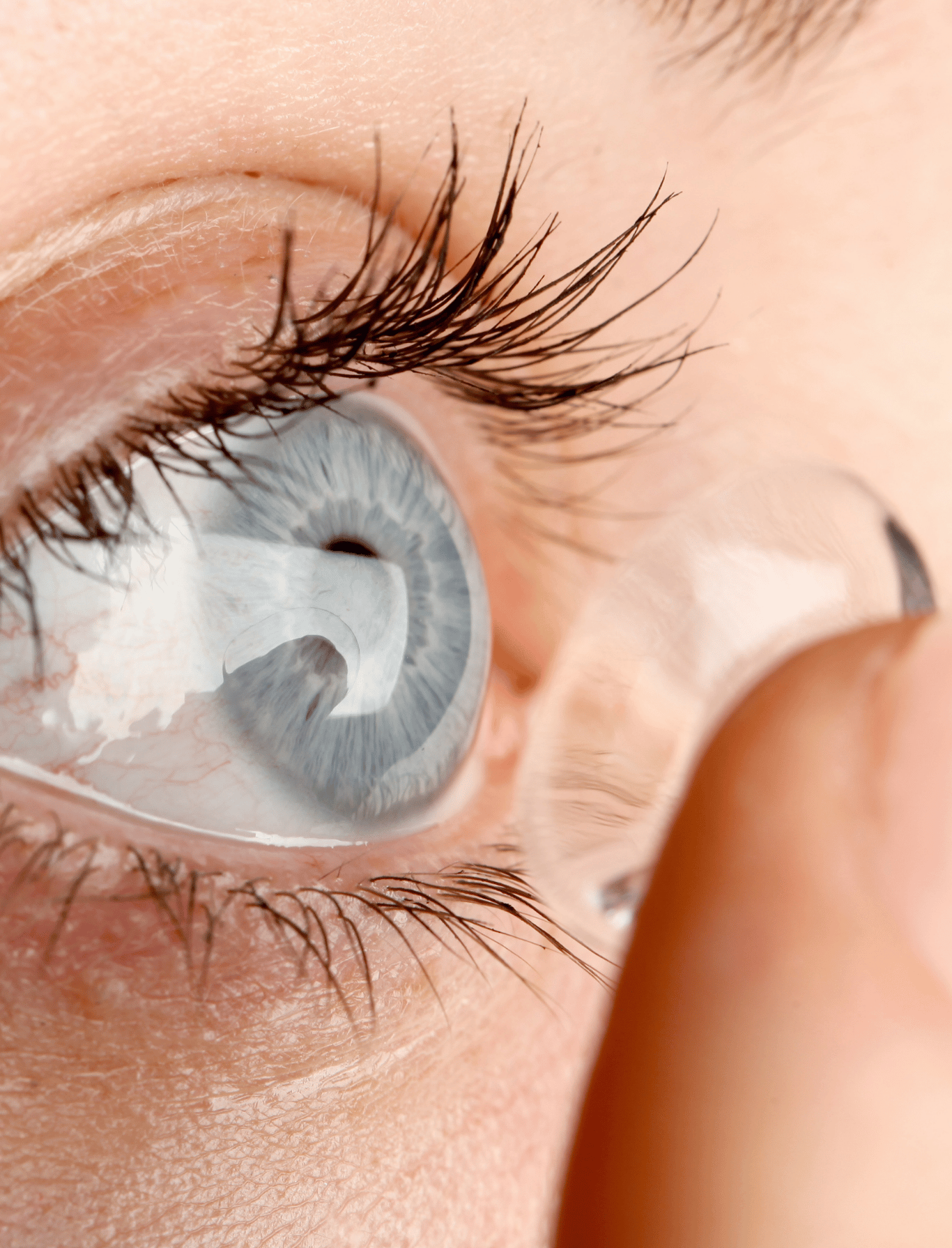 Softlens